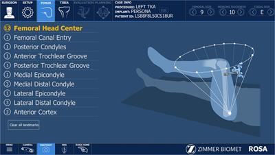 Personalized alignment™ for total knee arthroplasty using the ROSA® Knee and Persona® knee systems: Surgical technique